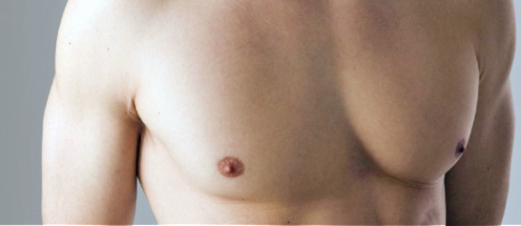 Protesi pettorali maschili: a cosa serve l’intervento